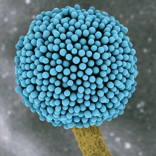 electron microscope of a Aspergillus Niger spore
